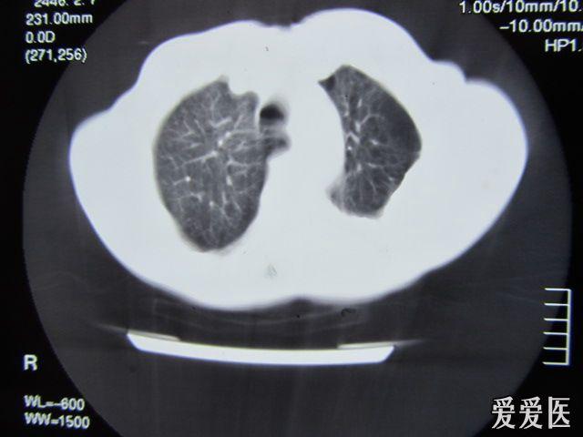 给大家爆料一下CT看穿仪怎样看穿普通碗里硬币 《新浪科技 讲解窍门》